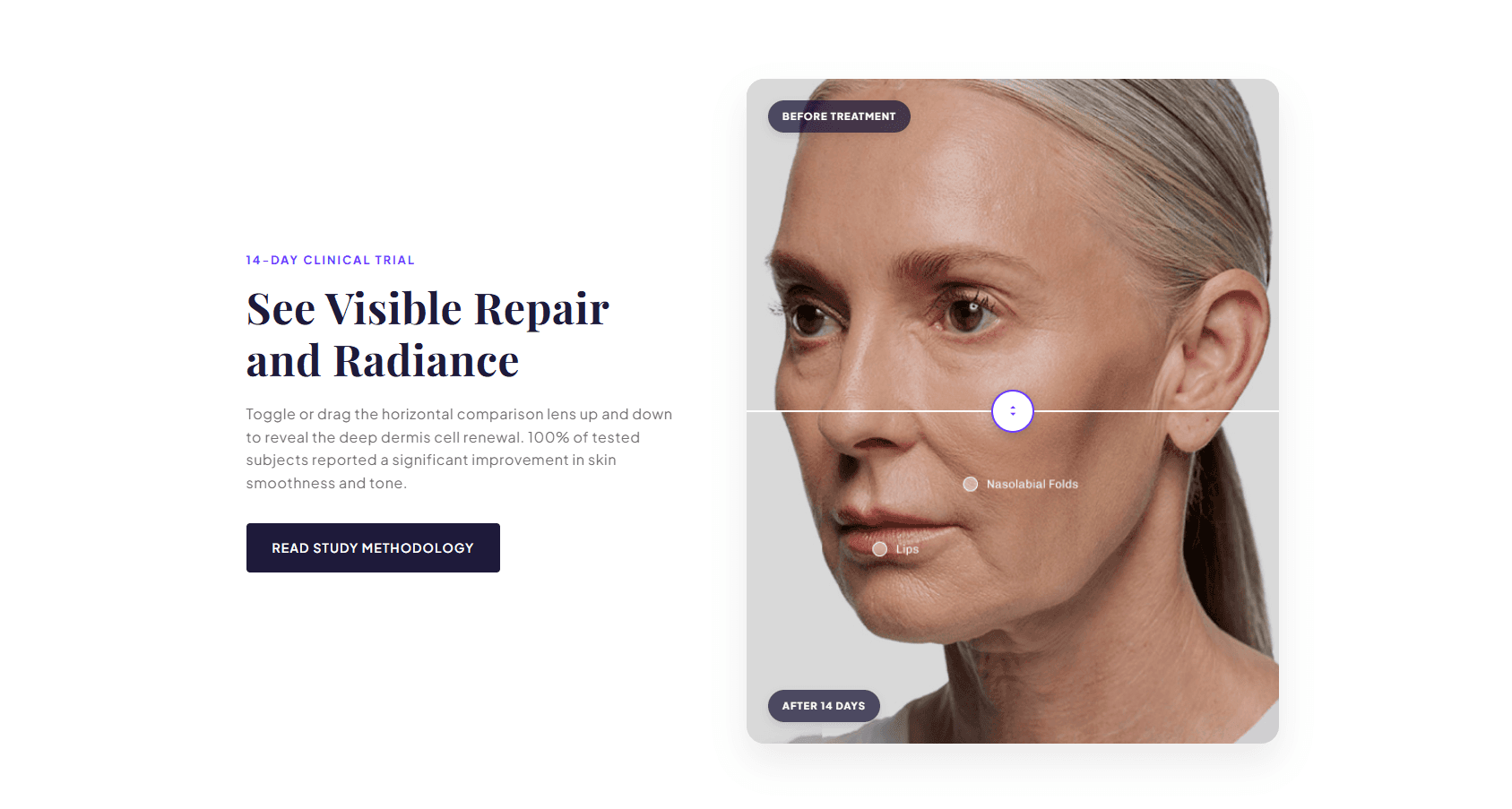 Preview of CS — Before-After #2